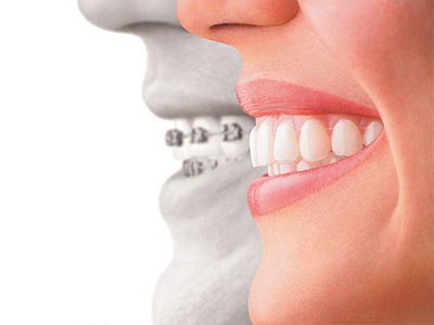 River Place Dental | Oral Cancer Screening, Tooth Replacement with Dental Implants and K  R Professional Teeth Whitening