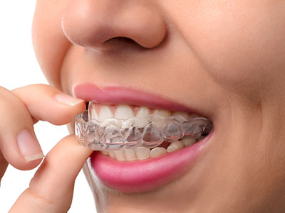 River Place Dental | Digital X-Rays, Intraoral Camera and CEREC   Same-Day Crowns