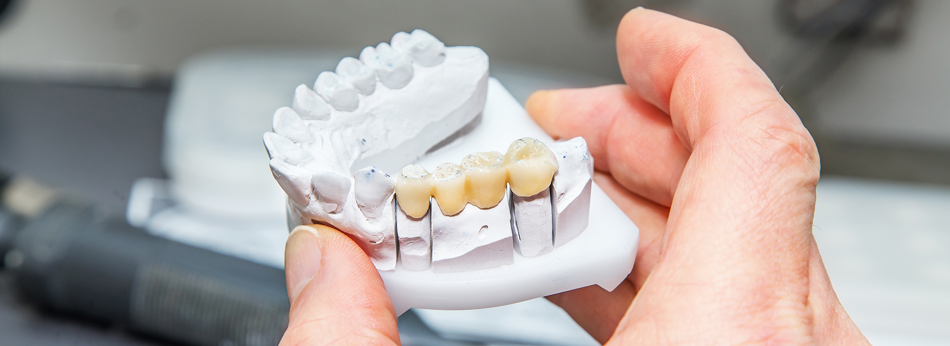 River Place Dental | Tooth Colored Fillings, Implant-Retained Denture and CEREC   Same-Day Crowns