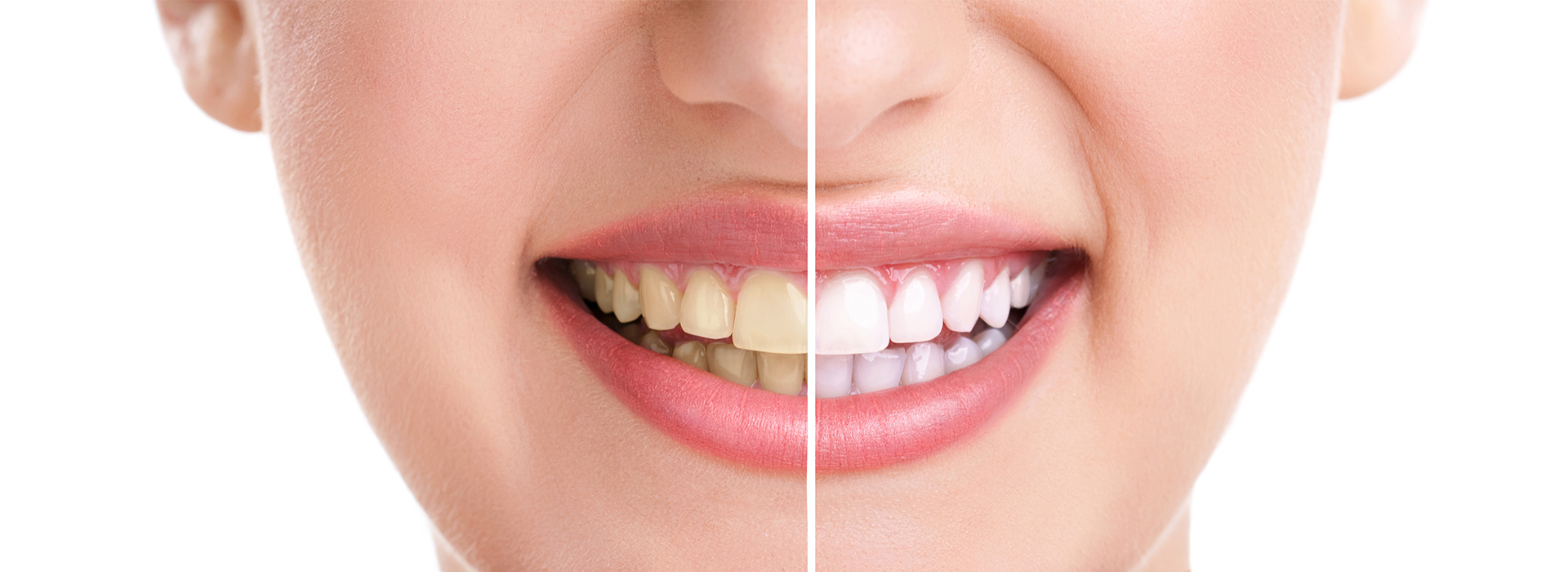 River Place Dental | Tooth Replacement with Dental Implants, Custom Mouthguards and Dentures